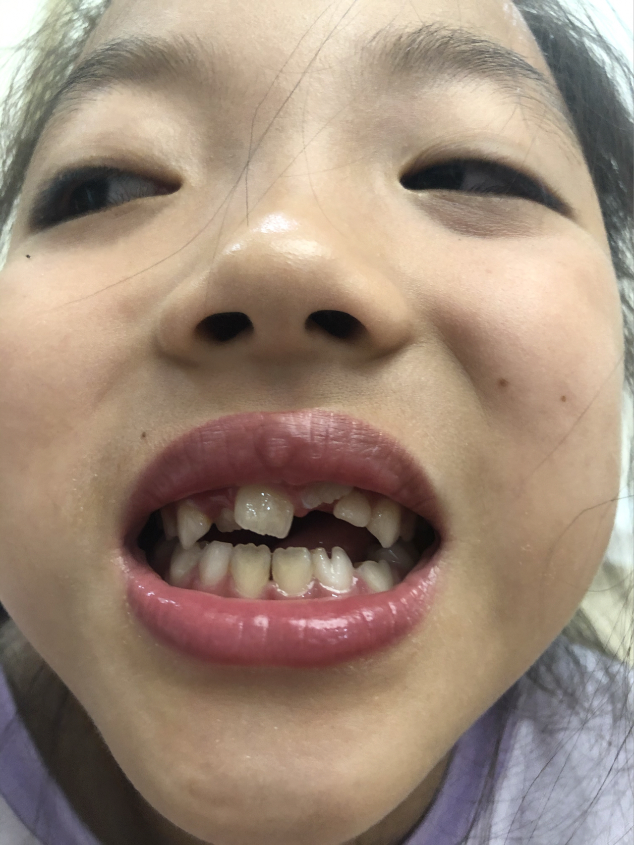 庄最新牙齿技术揭秘，牙齿美容新选择