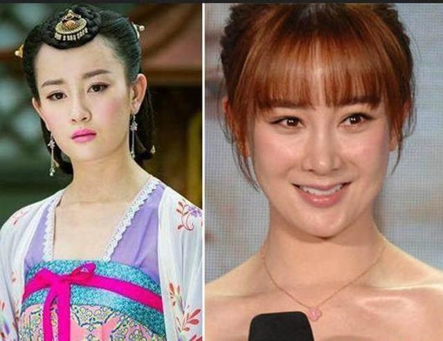 坦然面对整容，女明星的美丽新篇章之旅