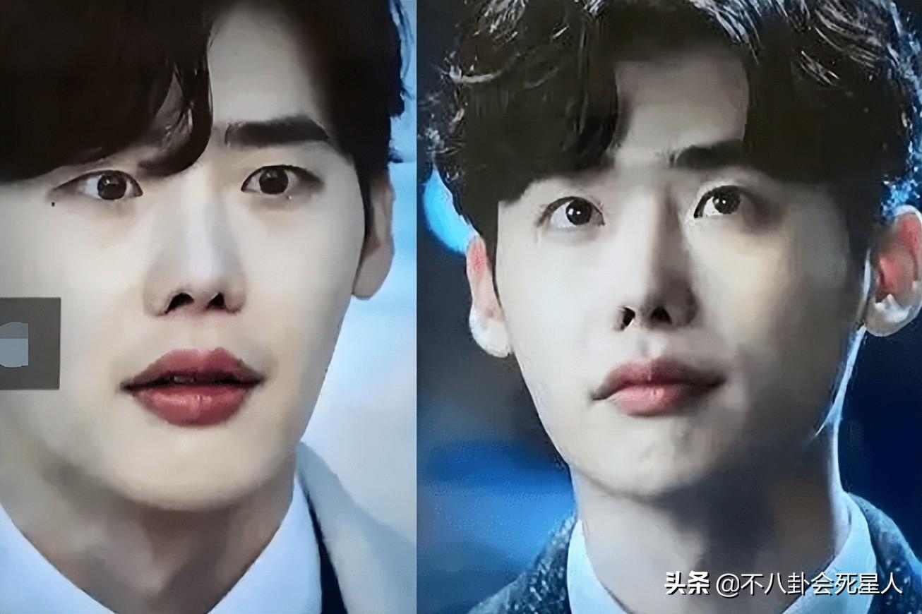 深度解析明星整容后遗症,观点与影响探讨