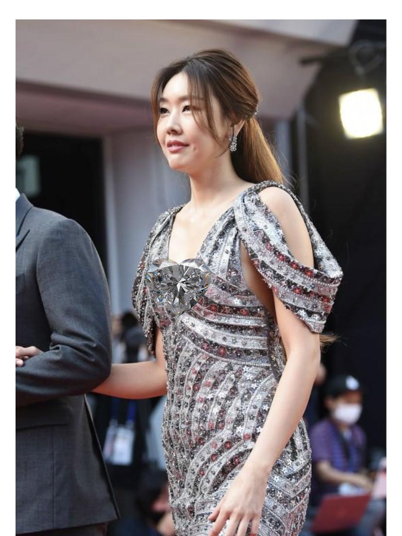 深度解析明星整容后遗症,观点与影响探讨