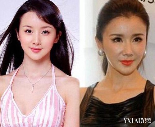 探秘明星整容的秘密，神秘美容小店的魅力所在！