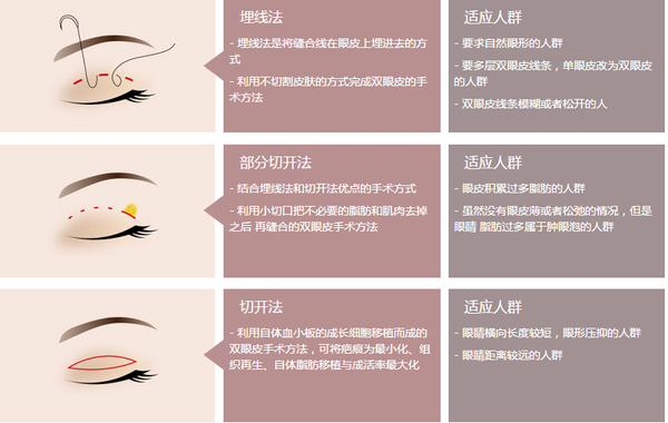 眼部整形最新技术揭秘